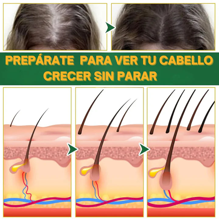 Suero para el crecimiento del cabello